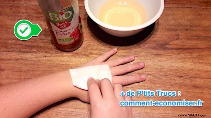 How To Disinfect And Heal A Wound WITHOUT DISINFECTANT. 