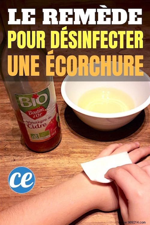 How To Disinfect And Heal A Wound WITHOUT DISINFECTANT. 