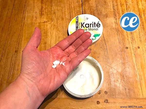 6 Grandma s Remedies To Say Goodbye To Dry, Damaged Hands. 