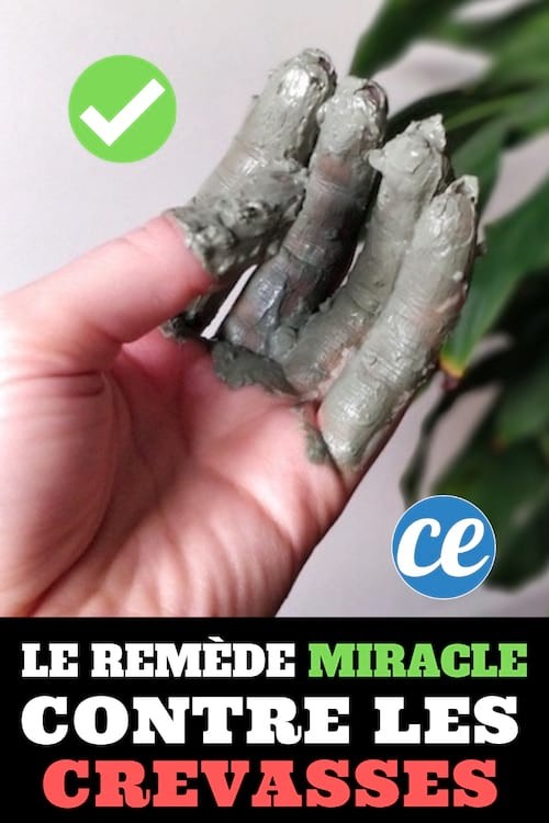 Finally A Miracle Remedy Against CRACKS On The Fingers. 