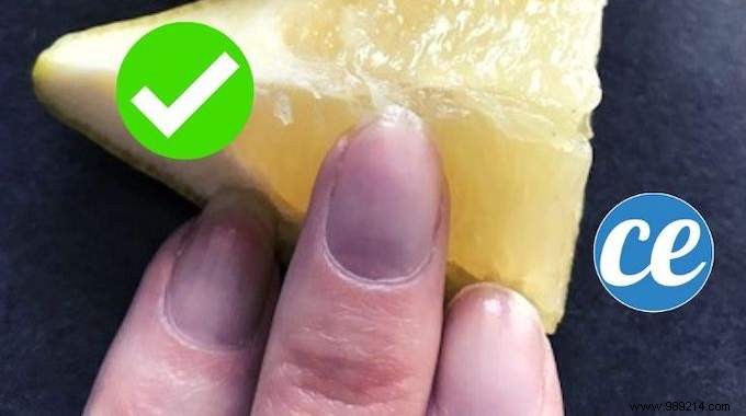 How To Whiten Yellowed Nails? The Magic Trick (Almost) Free! 
