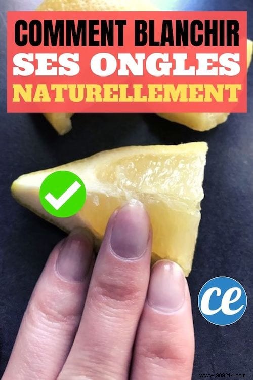 How To Whiten Yellowed Nails? The Magic Trick (Almost) Free! 