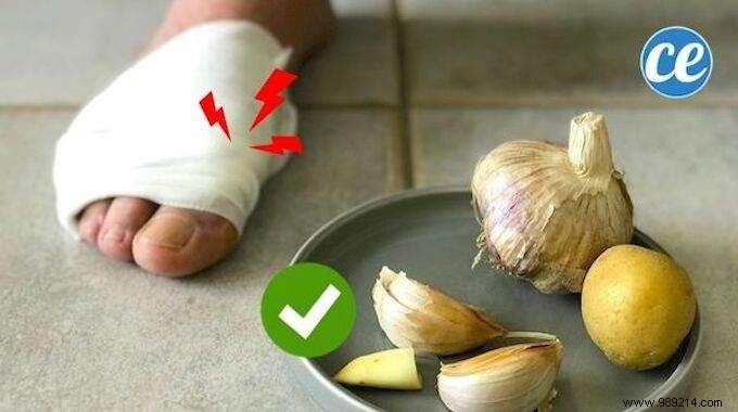 What to do in case of a gout attack? The Simple And Effective Remedy. 