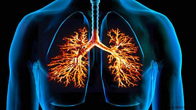 Acute Bronchitis:The Radical Remedy With Essential Oils. 