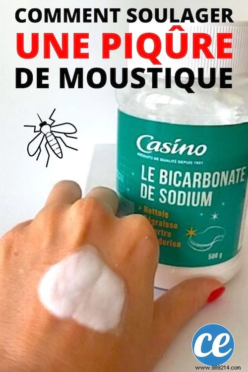 How To Relieve A Mosquito Bite With Baking Soda In 1 Min. 