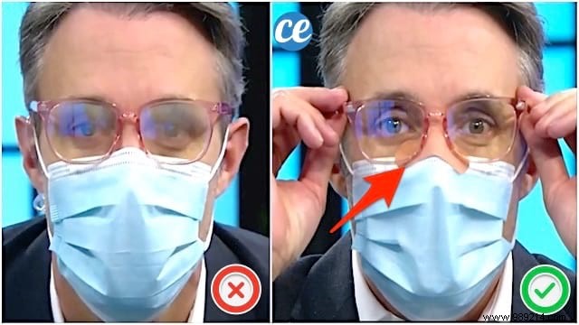 Wearing a Mask:A Surgeon s Tip to Avoid Fogging Your Glasses. 