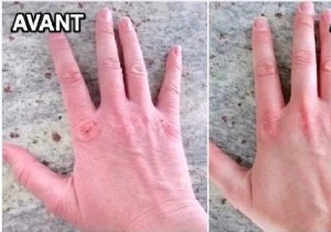 Hands Damaged By Hydroalcoholic Gel? The Miracle and Instant Remedy. 