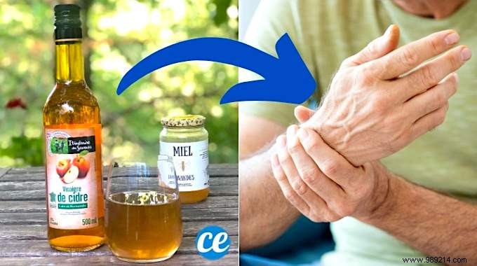 Rheumatism, Gout and Osteoporosis:3 Effective Remedies with Apple Cider Vinegar. 
