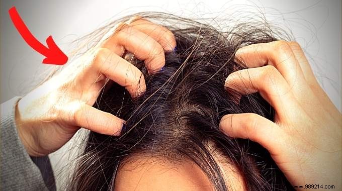 Itchy Scalp? 4 Remedies To Stop The Itching. 