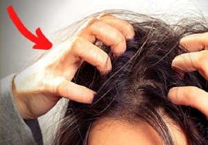 Itchy Scalp? 4 Remedies To Stop The Itching. 