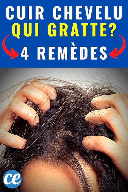 Itchy Scalp? 4 Remedies To Stop The Itching. 