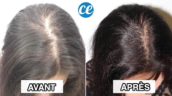 How to STOP Hair Loss? 11 Natural Remedies. 
