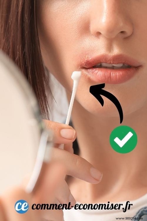 11 Grandma s Remedies To Cure A Cold Sore As Fast As Possible. 