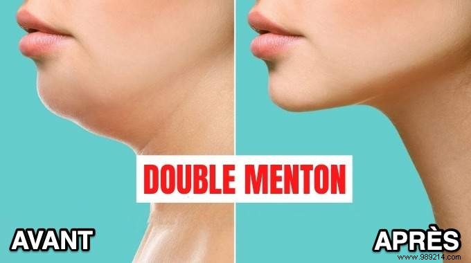 How to Lose Double Chin? 6 Quick and Easy Tips. 