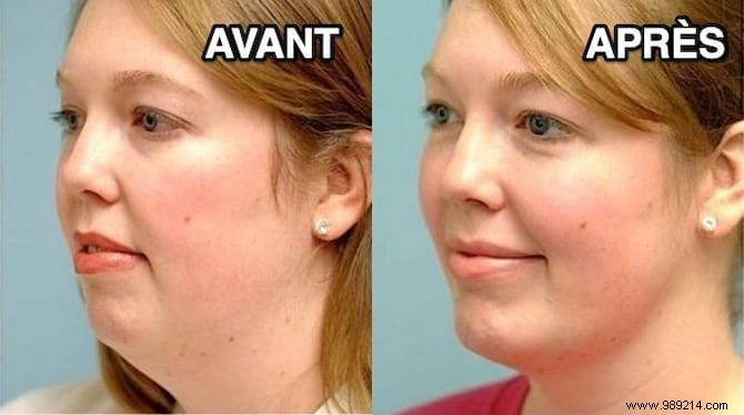 How to Lose Double Chin? 6 Quick and Easy Tips. 