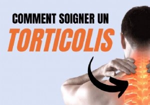 5 Effective Remedies To Cure Torticollis In 10 Seconds (Or Almost). 