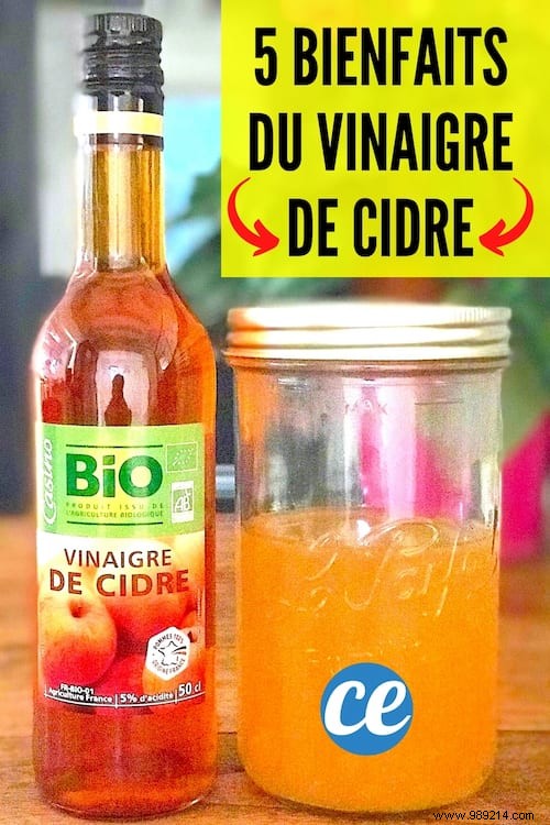 5 Amazing Benefits of Apple Cider Vinegar (That Nobody Knows). 
