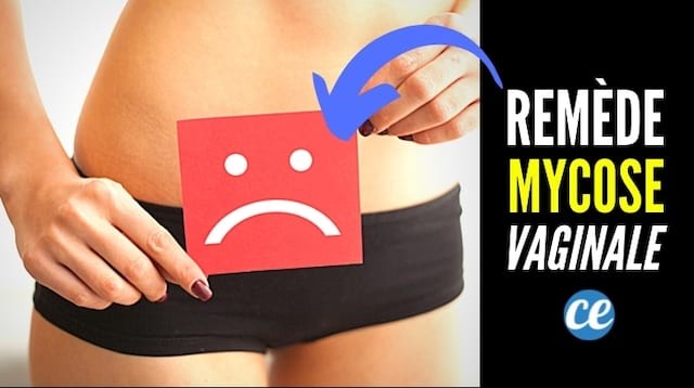 Vaginal Mycosis:How To Treat It Quickly (And WITHOUT A Prescription). 