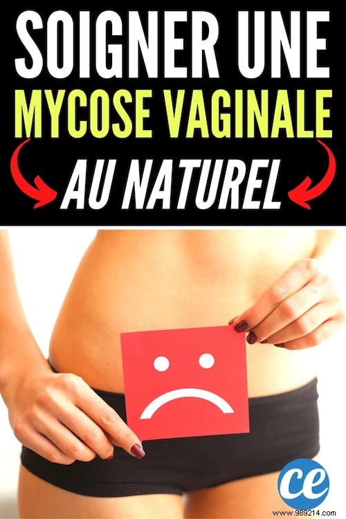 Vaginal Mycosis:How To Treat It Quickly (And WITHOUT A Prescription). 