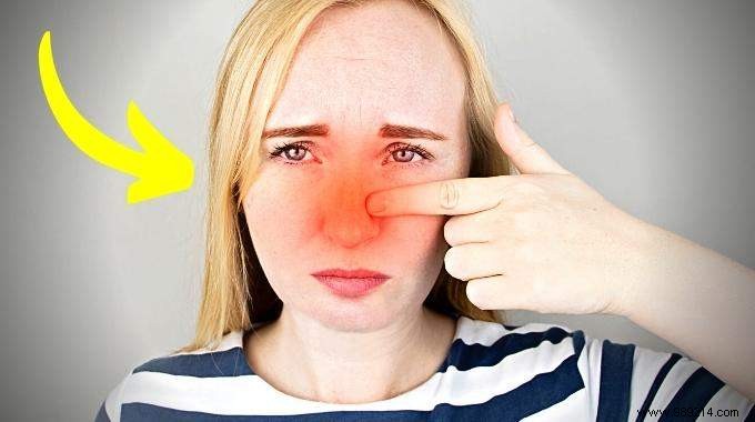 Dry and Irritated Nose? 9 Natural and Effective Grandmother Remedies. 