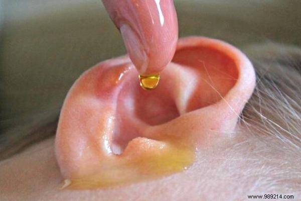 Forget Cotton Swabs! Here s How To Safely Clean Your Ears. 