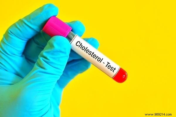 The 11 Foods Highest in Cholesterol (Including Those to Avoid at All Costs). 