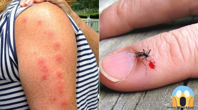 5 Grandma s Remedies To Soothe Any Insect Bite. 