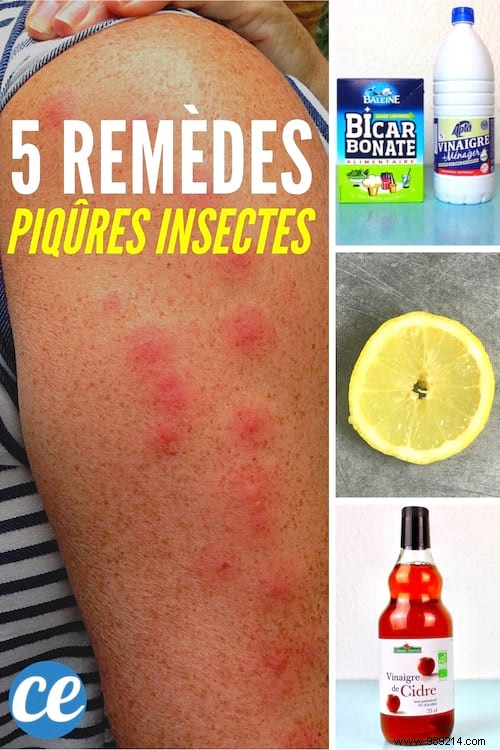 5 Grandma s Remedies To Soothe Any Insect Bite. 