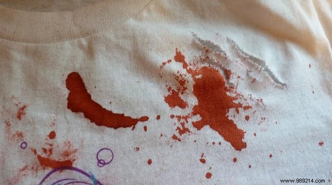 THE Trick That Works for Removing an Encrusted Bloodstain. 