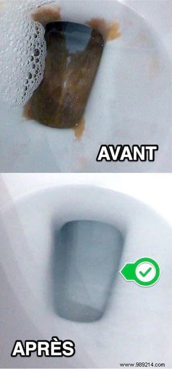 The Tip To Descale The Bottom Of The Toilet Bowl WITHOUT Effort. 