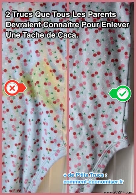 Poop Stains on Baby Clothes:How to Remove Them EASILY. 