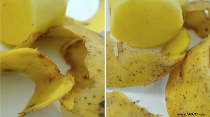 12 Incredible Ways to Use Potato Peelings. 