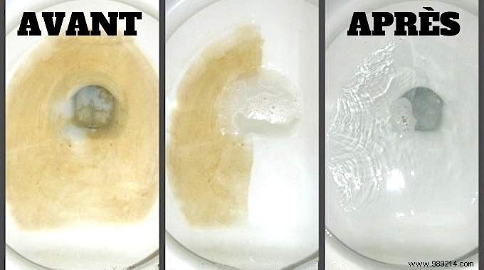 7 Simple And Effective Tricks Against Tartar In Toilets. 