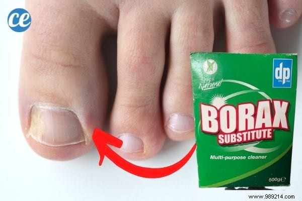 10 Amazing Uses of Boric Acid (That Nobody Knows). 