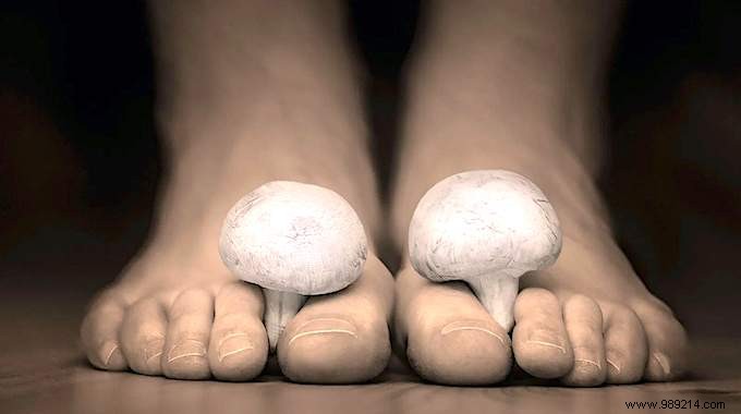 My Feet Stink:The Magic Recipe To Eliminate Odors. 
