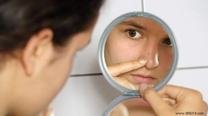 An Acne Trick to Try to Make Pimples Go Away. 