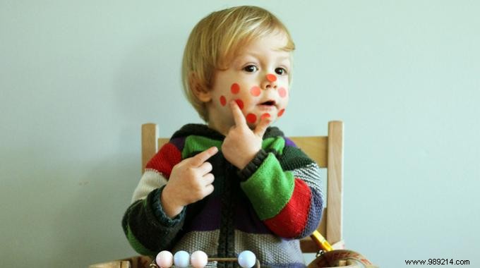 Did you know ? Homeopathy Relieves Chickenpox Itching. 