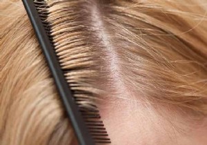 Grandma s Proven Salt Remedy: Banish Dandruff Naturally and Effectively