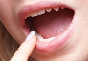 Natural Canker Sore Relief: Propolis, the Effective Bee-Made Remedy