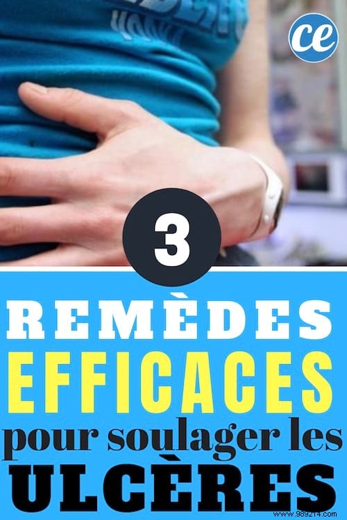 3 Effective Remedies That Relieve Stomach Ulcers. 