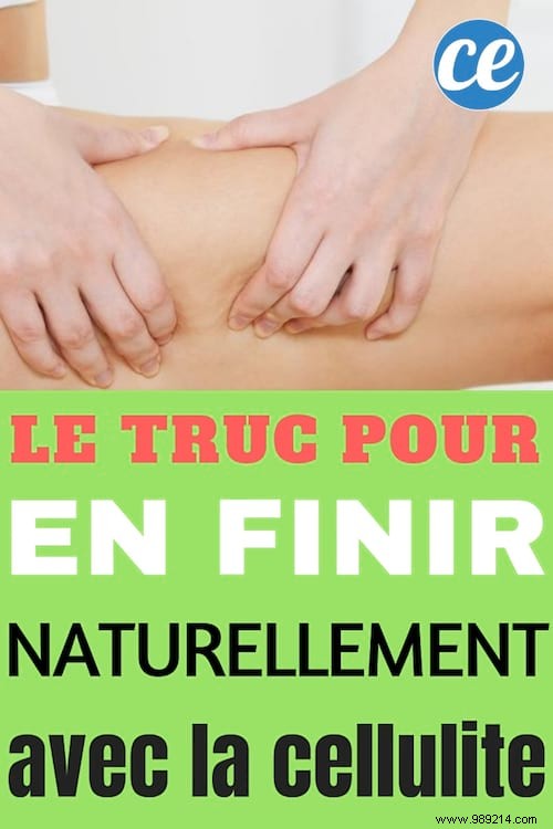 How To Make Cellulite Disappear Naturally? THE Trick To End. 