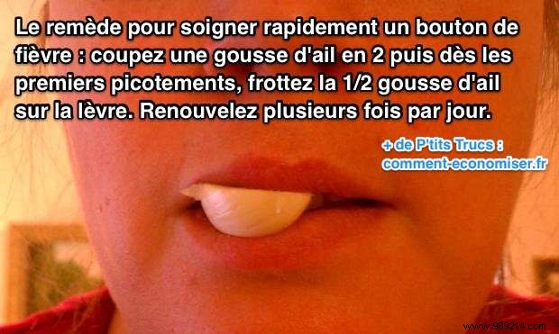 The Secret Remedy To Make A Cold Sore On The Lip Disappear. 