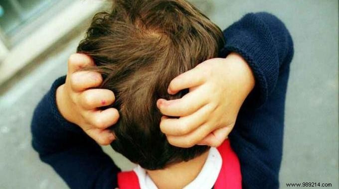 The 10 Best Natural Lice Remedies. 