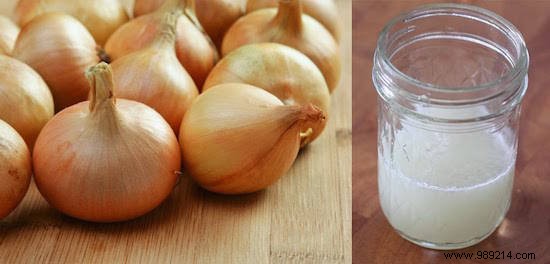 12 Home Remedies To Grow Hair Faster. 
