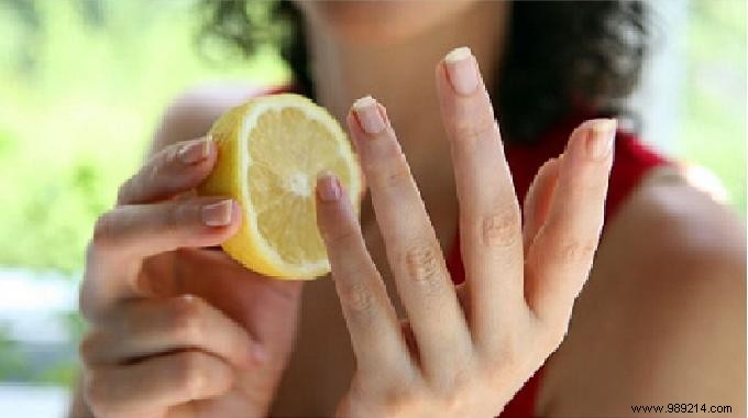 Smokers:How To Get Rid Of Yellow Spots On Your Fingers? 