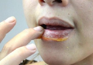 Heal Chapped Lips Naturally with Honey: A Proven Remedy
