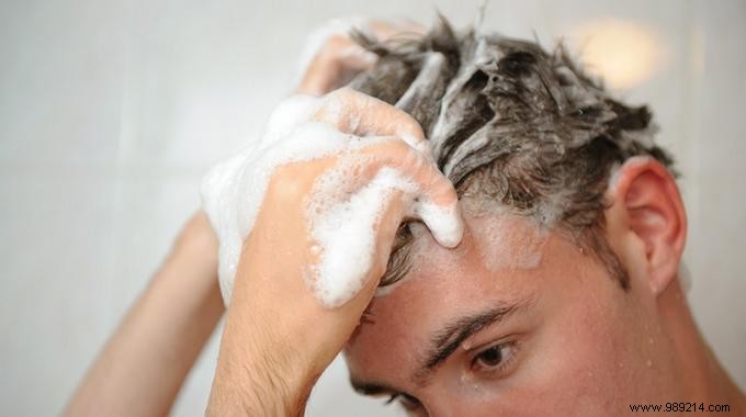 The Remedy NOBODY KNOWS To Say Goodbye To Dandruff. 