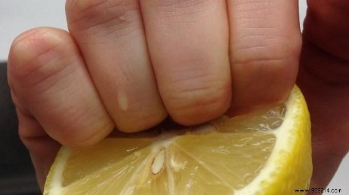 Yellow nails? What To Do To Have Beautiful Hands Easily. 