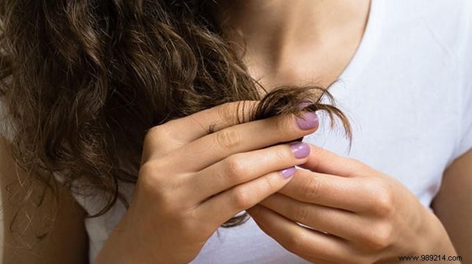 Castor Oil:6 Incredible Benefits For Hair And Skin. 