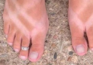 The Effective Grandmother s Remedy To Cure A Sunburn. 